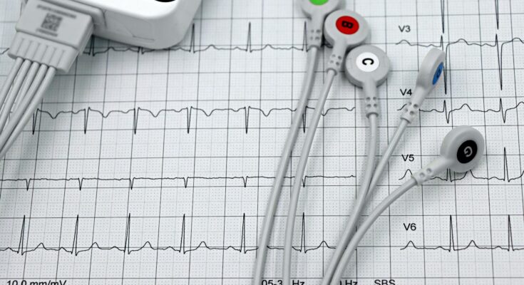 ekg papier elektrody kable