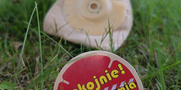 Stomia – co to jest i kiedy się ją zakłada?