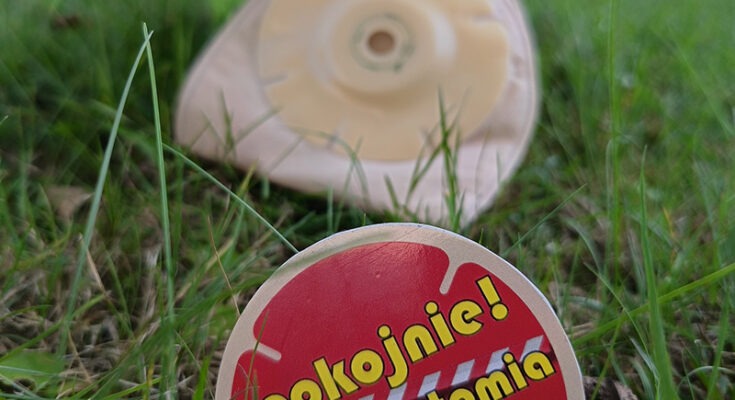 Stomia – co to jest i kiedy się ją zakłada?